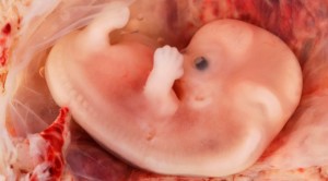 EmbrionHumano9Semanas_WikipediaEdUthmanCC-BY-2.0_240615