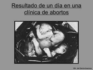 el-aborto-21-728